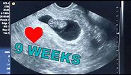 9 Weeks Pregnant - ULTRASOUND❤️