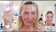 ☀️Nano Needling | How to needle at home for SERIOUS glow!!