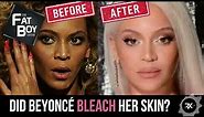 THE FATBOY SHOW: Did Beyoncé Bleach Her Skin?