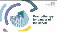 Brachytherapy for cancer of the cervix