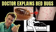 Doctor explains BED BUGS - including SYMPTOMS, TREATMENT AND PREVENTION ( +PHOTOS!)