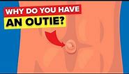 Outie Belly Button - Why Do Some People Have It?