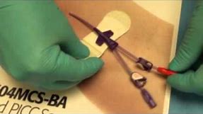 How to use Bard Grip-Lock PICC Catheter Hub Securement | Bard Catheter Securement Device