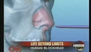Human Blockhead Explained on CNN