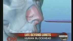 Human Blockhead Explained on CNN