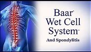 Baar Wet Cell System and Spondylitis