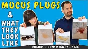What does the mucus plug look like compared to other discharge? | Mucus plug pictures and colors