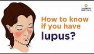 Systemic Lupus Erythematosus (SLE): Symptoms, Diagnose And Treatment | Rheumatology