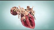 Ventricular Fibrillation (V-Fib): Terminal Cardiac Rhythm
