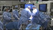Cleveland Clinic performs its first purely laparoscopic living donor surgery for liver transplant