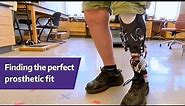 Finding the perfect prosthetic fit - Sanders UW Research Labs