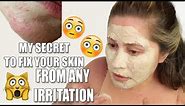 GET RID OF SKIN RASHES ON FACE | Allergic reaction