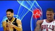 All NBA in-game ACL Tears (2012-2019)