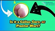How to Tell the Difference Between a Callus, a Corn, and a Plantar Wart