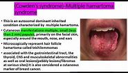 Squamous cell papilloma EVERYTHING you need to know,Etiology,clinical features, histopath, treatment