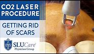 CO2 Laser Resurfacing Treatment For Getting Rid of Scars - Full Procedure
