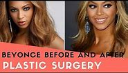 Beyonce Before and After Plastic Surgery