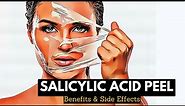 Flawless Complexion or Skin Sensitivity? Understanding the Effects of Salicylic Acid Peels