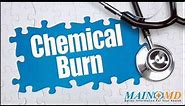 Chemical Burn ¦ Treatment and Symptoms