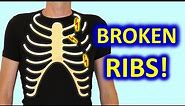 6 Do’s & 6 Don’ts To Recover From Broken Ribs