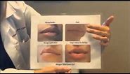 Characteristics of the lips and choosing the right filler.