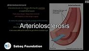 Arteriolosclerosis, Biology Lecture | Sabaq.pk |