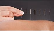 The Science Behind How Acupuncture Helps Relieve Pain: A Doctor Of Chinese Medicine Explains