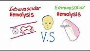 Intravascular Vs Extravascular Hemolytic Anemia; What's The ACTUAL Difference?