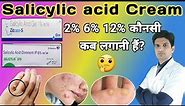 Salicylic acid ointment | Salicylic acid cream | zitcare s gel | salicylix sf6