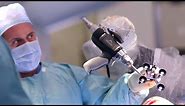 Knee replacement using the Stryker Mako Robot