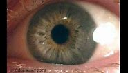 Eye Works 1: Focusing: Cornea, Iris and Lens