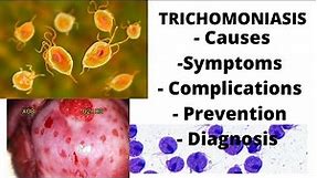 Trichomoniasis - symptoms, causes, complications, prevention & diagnosis