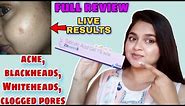 best salicylic acid gel review | zitcare s gel for acne, blackheads, Whitehead, clogged pores