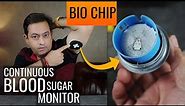Monitor Blood Sugar Without Needles: Game-Changer Tech! - UltraHuman M1