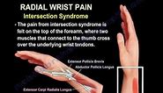 Wrist Pain,causes and treatment,Part 2 - Everything You Need To Know - Dr. Nabil Ebraheim