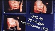 USG 4 dimensi hamil 28 minggu murah di malang