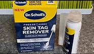 Dr. Scholl’s Skin Tag Remover | Application and After 7 day Results