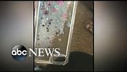 Glitter iPhone cases recalled after causing burns