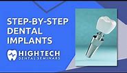 Step-by-Step Dental Implants by High Tech Dental Seminars