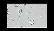 Trichomonas vaginalis | trichomoniasis urine |Trichomonas in urine microscopy #laboratory #zee lab
