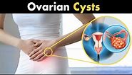 What is Ovarian Cysts? | Types, Causes and Symptoms