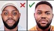 Remove DARK CIRCLES Under Your Eyes (How I Did It) Men's Skin Care