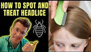 How to spot and treat Head lice (nits) | Doctor O'Donovan explains...