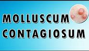 Molluscum Contagiosum Symptoms and Treatment
