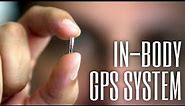 Why an in-body GPS tracker is really useful | ReMix in-body GPS microchip
