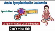 Acute Lymphoblastic Leukemia(ALL) | clinical presentation of ALL |diagnosis of ALL| Treatment of ALL