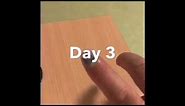 100 Days Smashed Finger Nail Recovery Process
