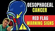 Warning signs & symptoms of OESOPHAGEAL(AKA esophageal /gullet) CANCER - Doctor O'Donovan explains