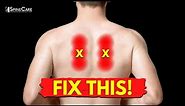 How to Fix SHARP Pain Between the Shoulder Blades