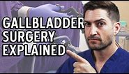 Gallbladder Surgery Explained - Complications and Recovery